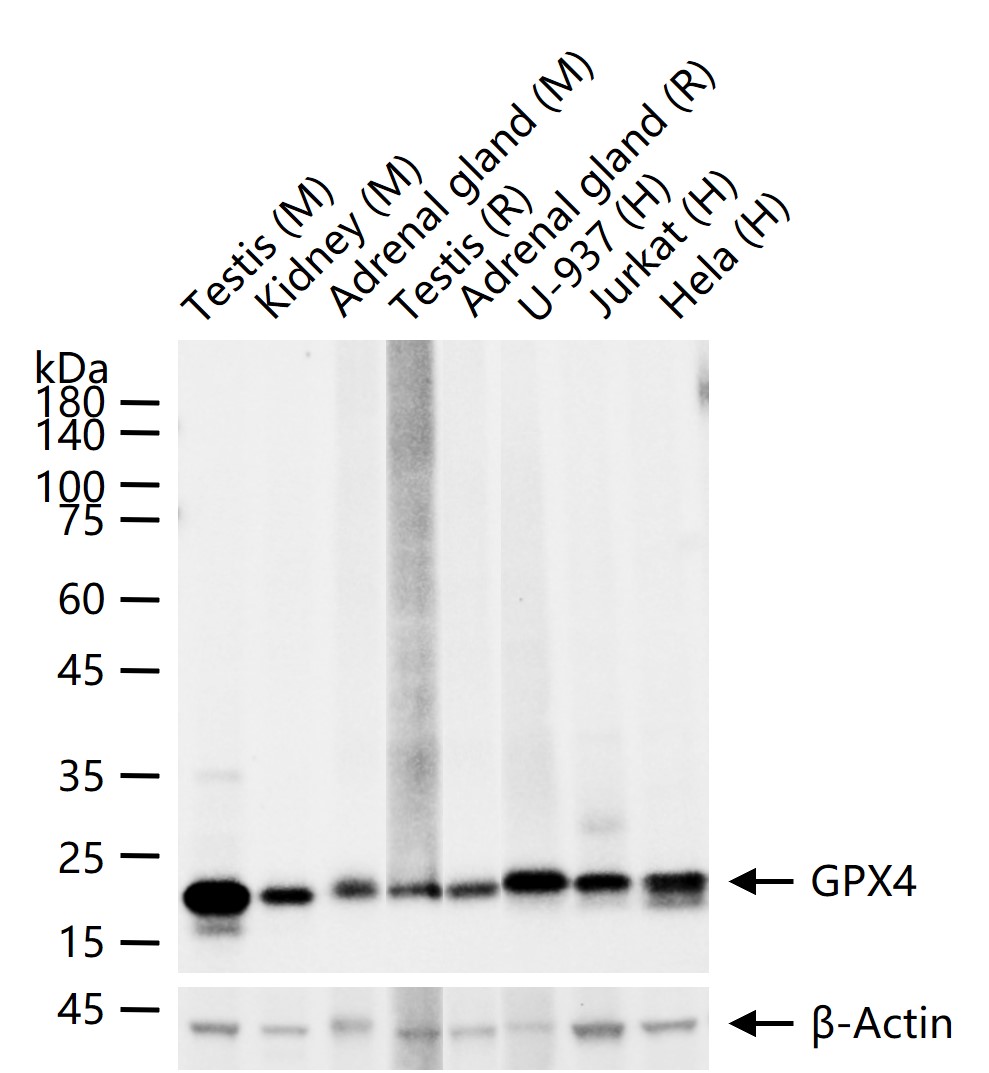 GPX4 Recombinant Rabbit mAb(bs