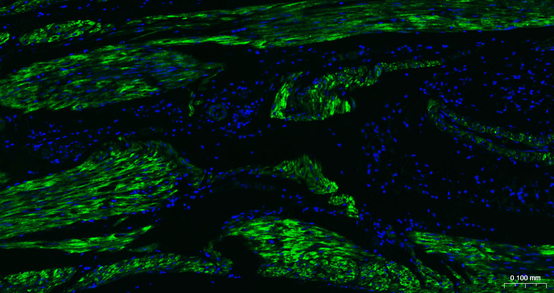 alpha smooth muscle Actin Mous