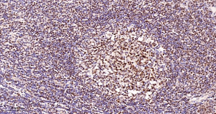 Cleaved PARP1 p25 Recombinant 