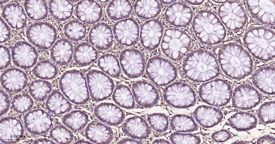 eIF3B Recombinant Rabbit mAb(b