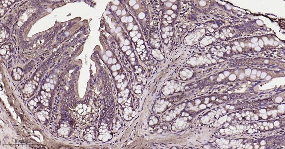RAB8A Recombinant Rabbit mAb(b