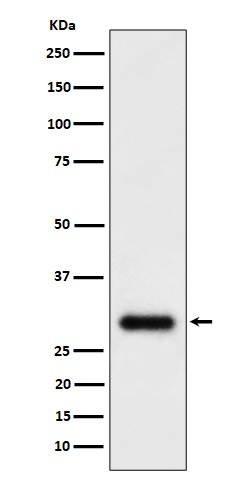 TMEM192 Recombinant Rabbit mAb