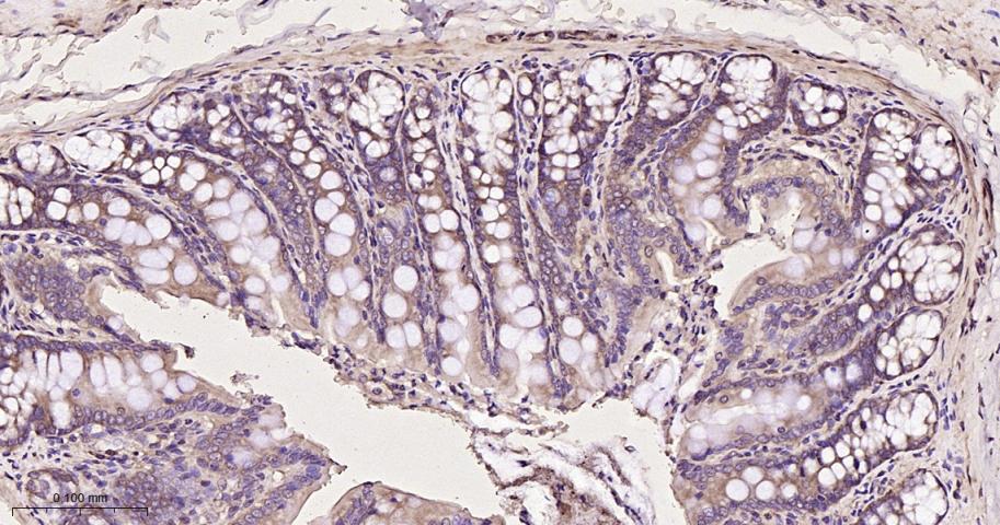 eIF3B Recombinant Rabbit mAb(b