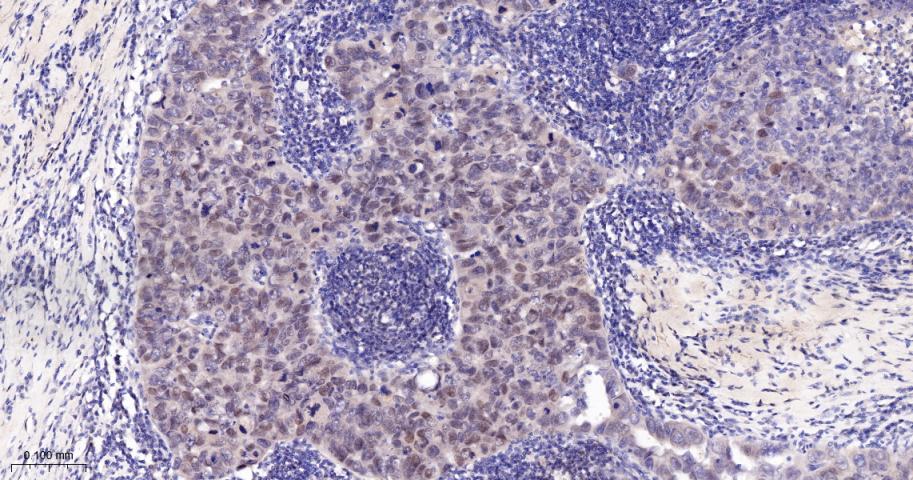 Cleaved PARP1 p25 Recombinant 