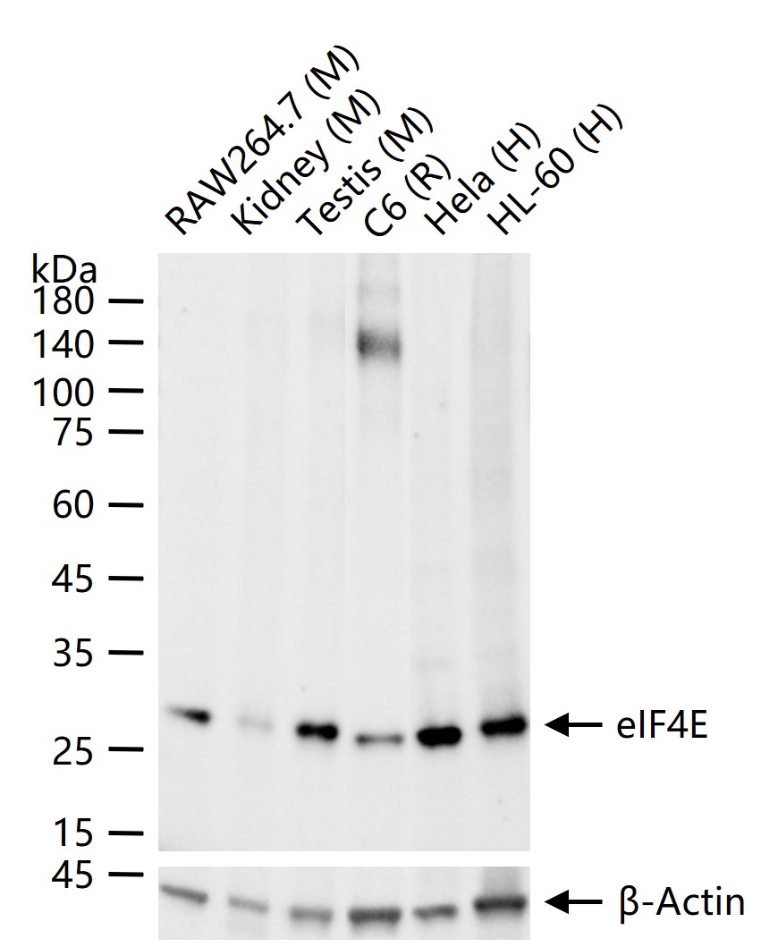 eIF4E Recombinant Rabbit mAb(b