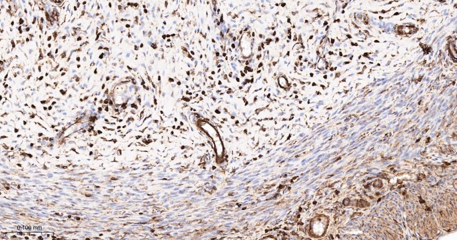 beta-Actin Rabbit pAb, Loading