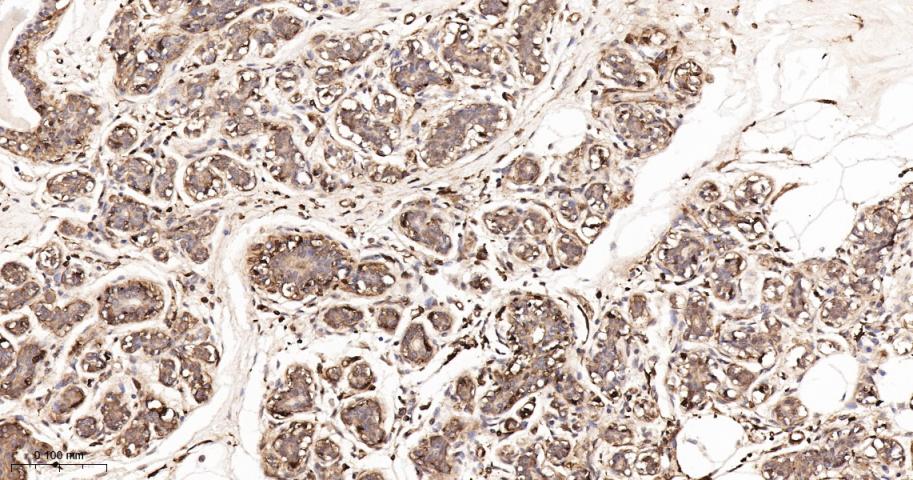 beta-Actin Rabbit pAb, Loading