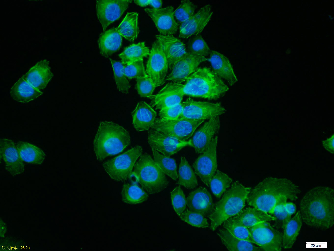 beta-Actin Rabbit pAb, Loading