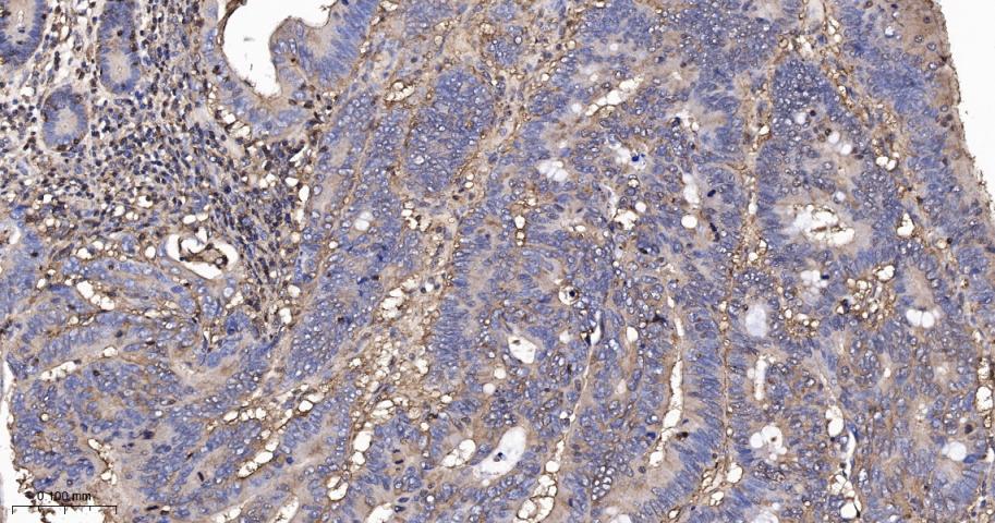 beta-Actin Rabbit pAb, Loading