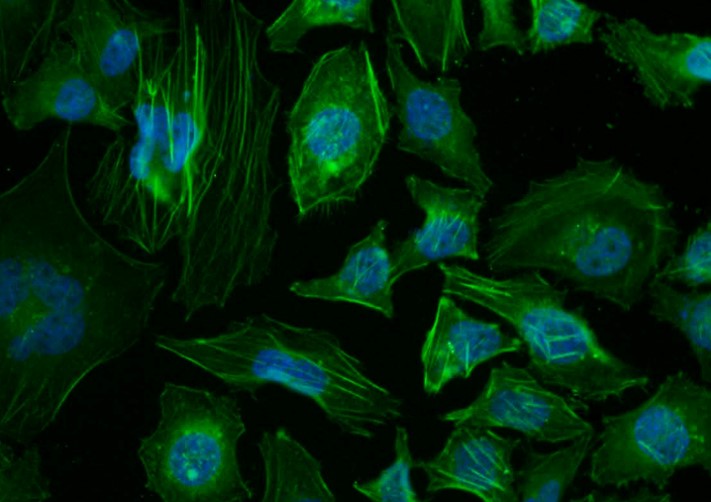beta-Actin Rabbit pAb, Loading