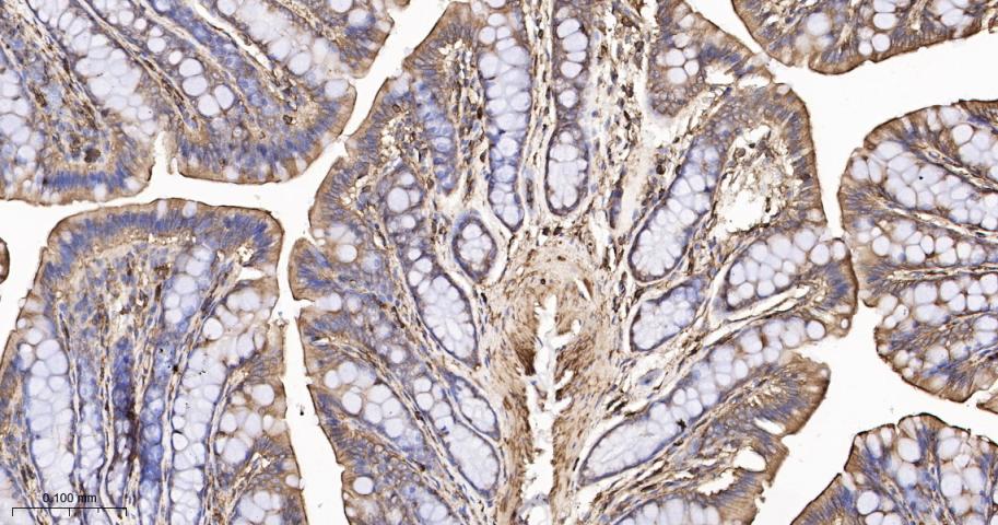 beta-Actin Rabbit pAb, Loading