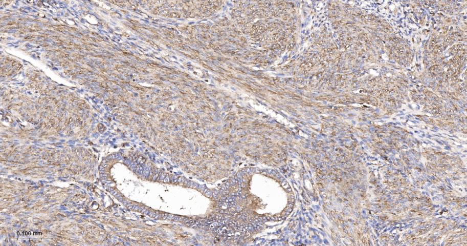 beta-Actin Rabbit pAb, Loading