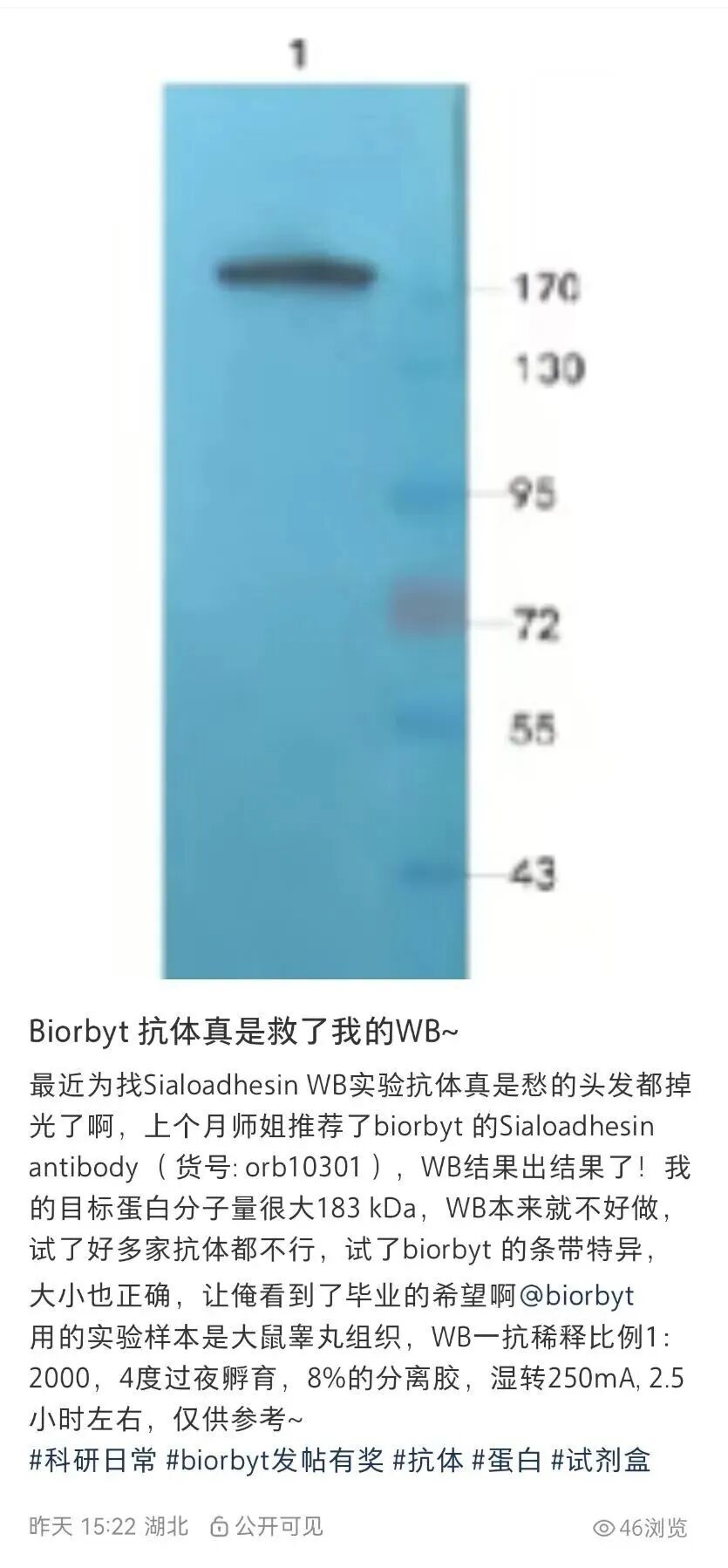 分享我的实验日记 | 科研路上，zui好的礼物是满意的结果