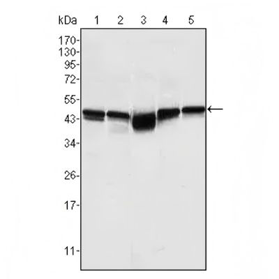 Abcam Anti-GSK3 beta抗体[3D10]
