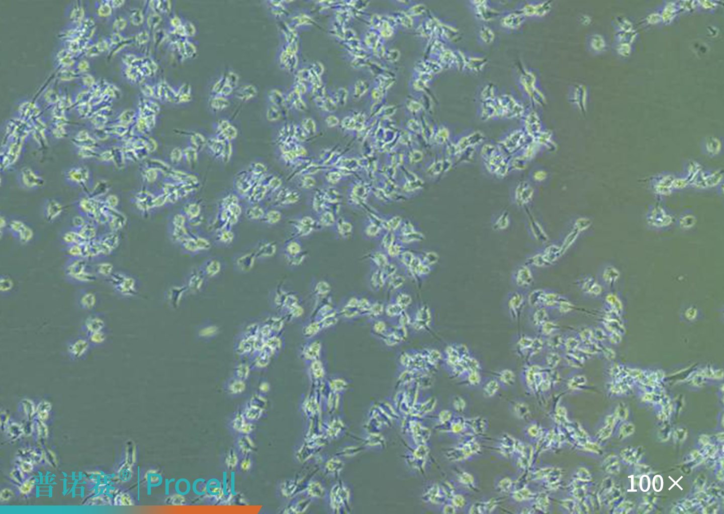 大鼠骨髓间充质干细胞消化后