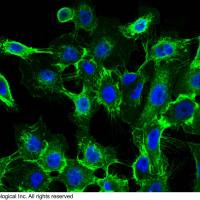 EGFR|EGFR antibody|EGFR抗体|Anti-Human 兔单抗