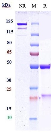 Anti-human PCSK9 (Ebronucimab 