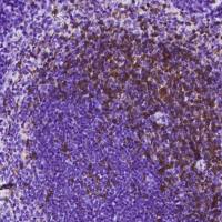 CD4 Antibody, Rabbit MAb | 兔单抗