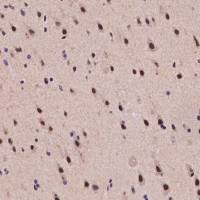 TRIM33 Antibody, Rabbit PAb, Antigen Affinity