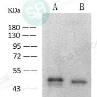 Coronavirus Nucleocapsid 兔单抗(Anti-2019-nCoV)