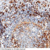 CD14 Antibody, Rabbit MAb | CD14 兔单抗