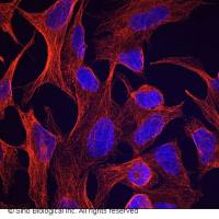 Beta-Tubulin Loading Control Antibody, Mouse MAb | Beta-Tubulin 内参抗体 (鼠单抗)