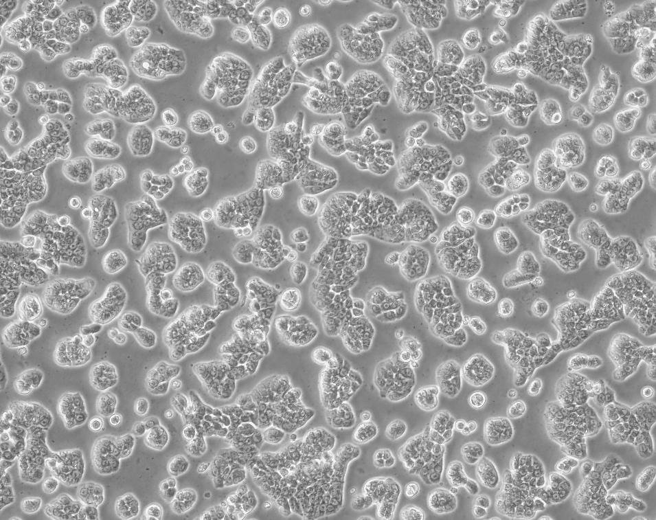 细胞攻略 | HT-29(人结肠癌细胞)培养教程