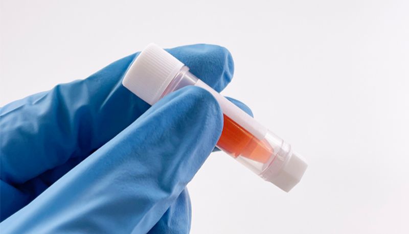 实验室必备！如何正确选择和使用冻存管？这些小技巧你知道吗？