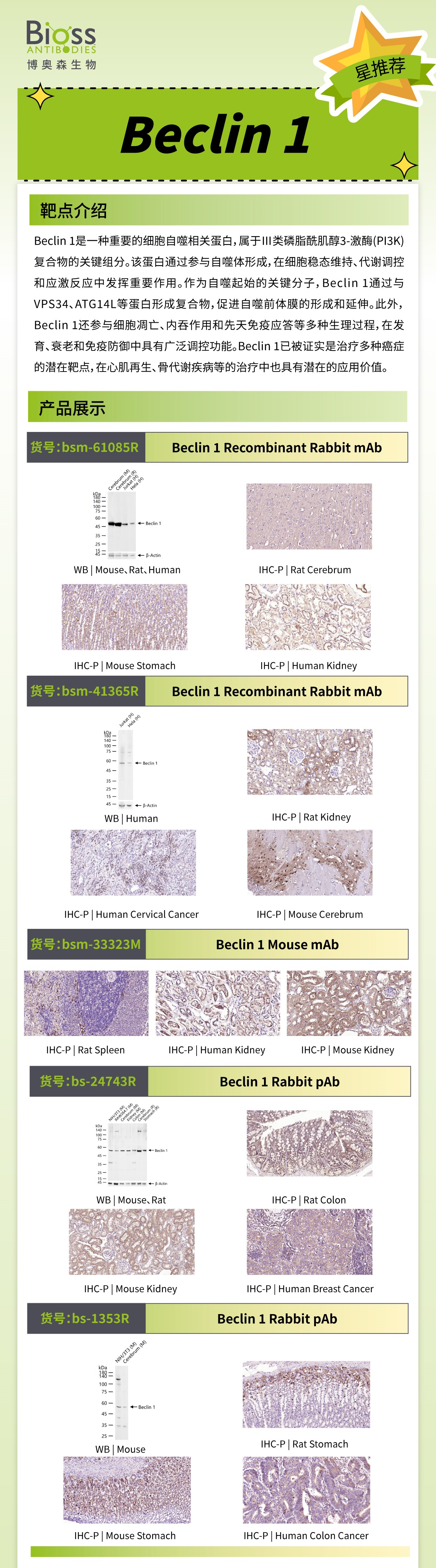 Bioss 星推荐 | Beclin 1 抗体