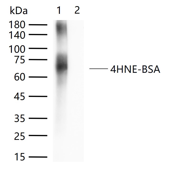 Bioss爆品推荐 | 从4-HNE靶点入手,揭开疾病“氧化损伤”之谜