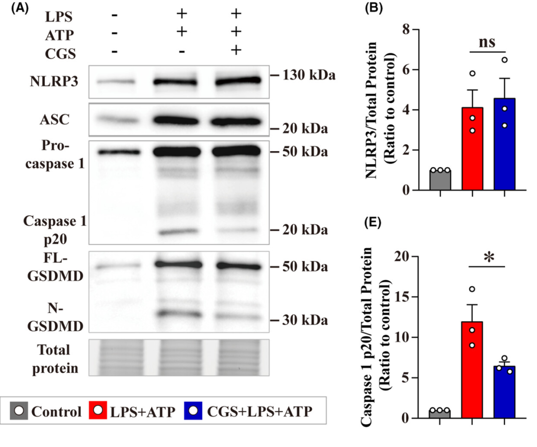 创伤性脑损伤炎症