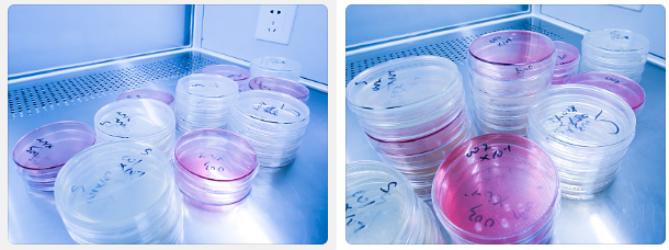 实验室养细胞经验总结：导致细胞死亡的“七宗罪”