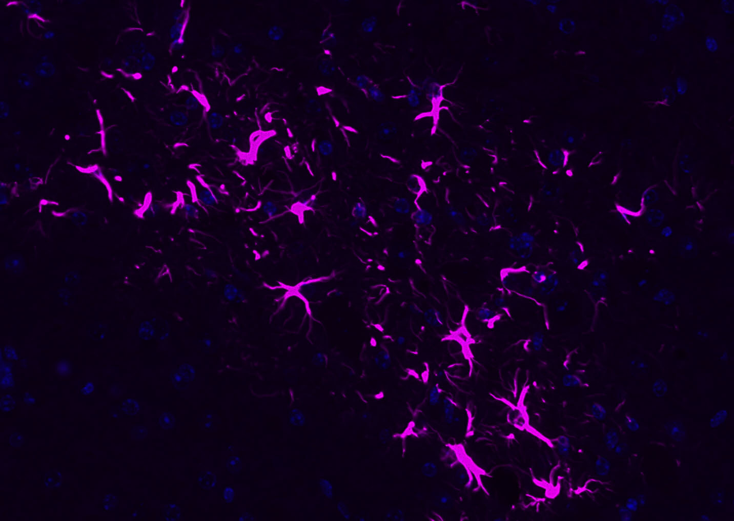 GFAP Rabbit pAb, Cy5 conjugate