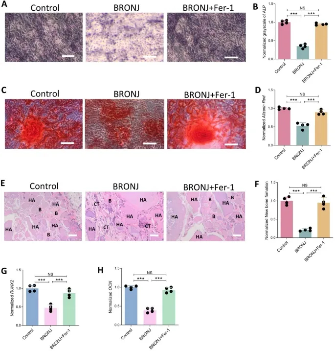 铁死亡服务 铁死亡服务