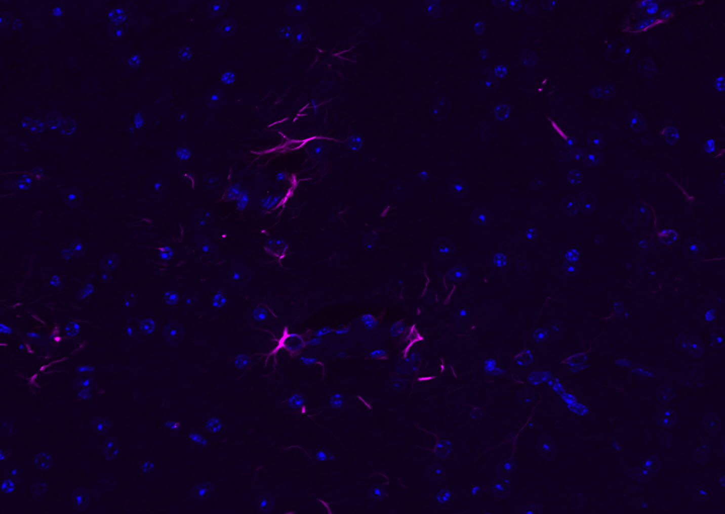 GFAP Rabbit pAb, Cy5 conjugate