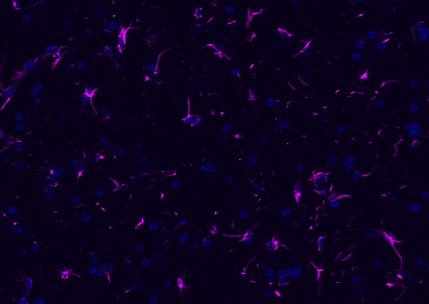 GFAP Rabbit pAb, Cy5 conjugate