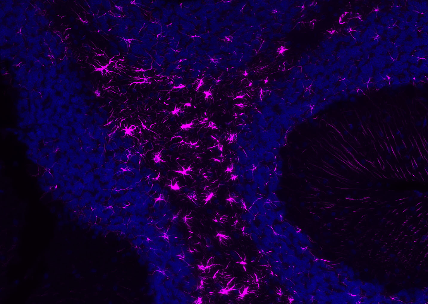 GFAP Rabbit pAb, Cy5 conjugate