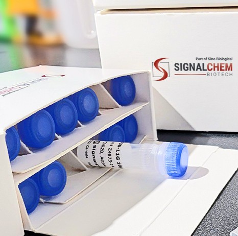 PKC epsilon/PRKCE重组蛋白|PKC epsilon, Active