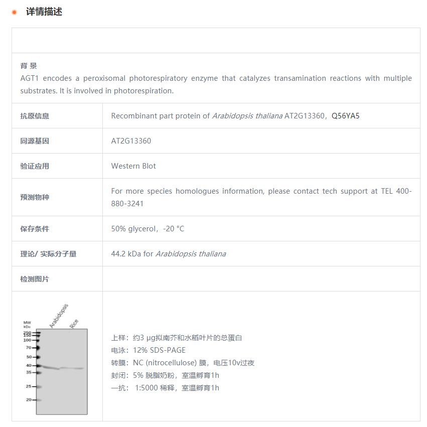 【植物抗体】Anti-AGT1/ Serine--glyox