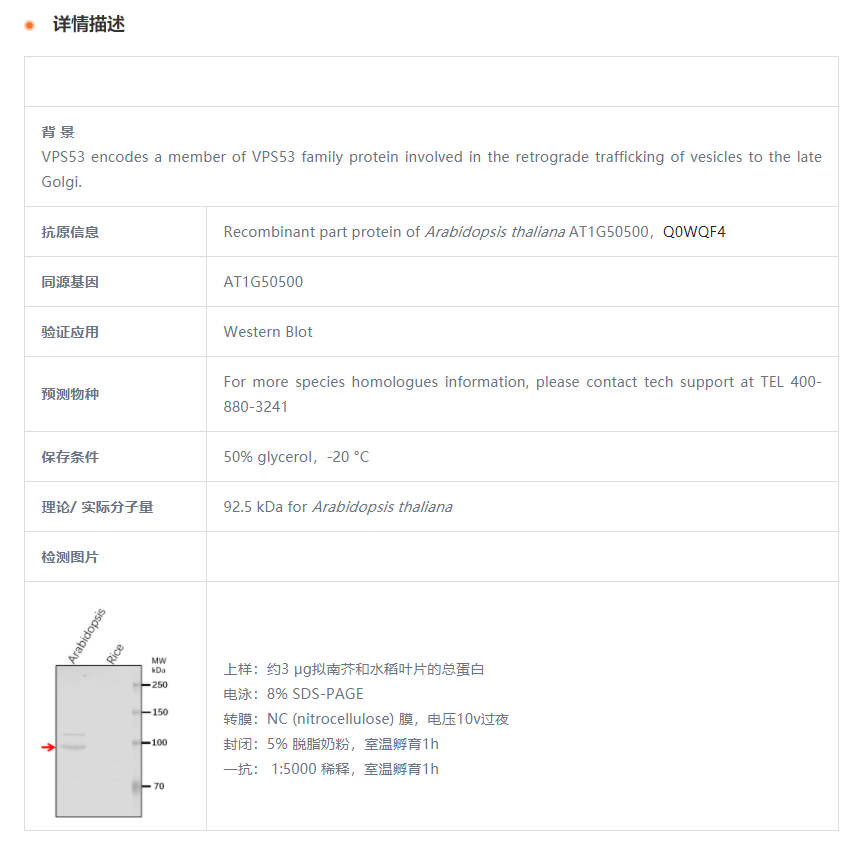 【植物抗体】Anti-VPS53/ Vacuolar pro