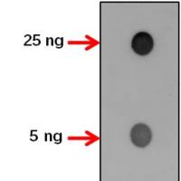 【植物抗体】Anti-ACBP1/ Acyl-CoA-binding domain-containing protein 1
