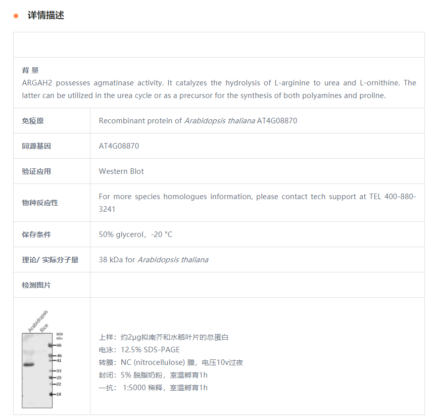 【植物抗体】Anti-ARGAH2/Arginine Ami