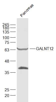 GALNT12 Rabbit pAb(bs-13272R)-