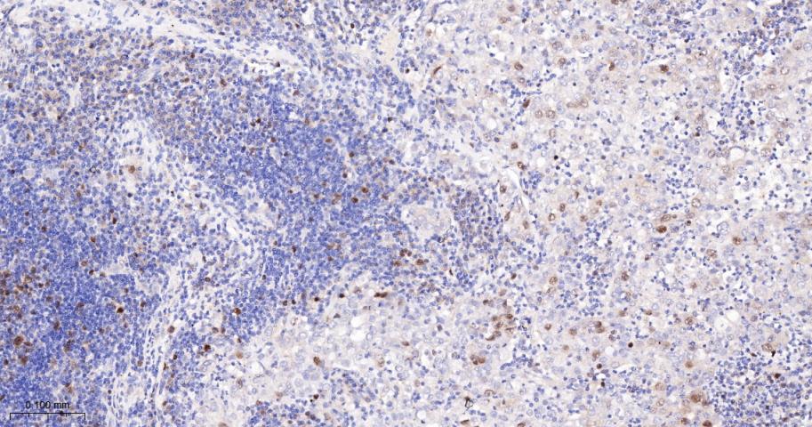 CCNA2 Recombinant Rabbit mAb(b