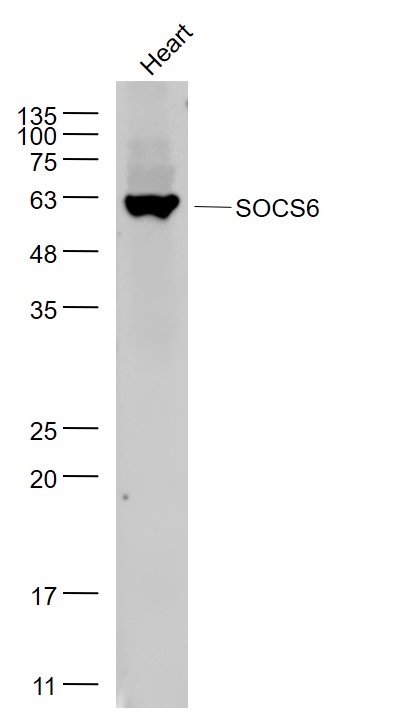 SOCS6 Rabbit pAb(bs-10685R)-50