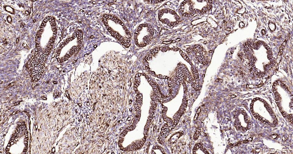 Vimentin Mouse mAb(bsm-33170M)