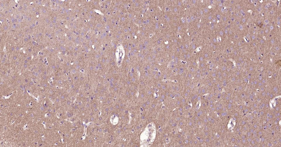 RAB5B Rabbit pAb(bs-11783R)-50