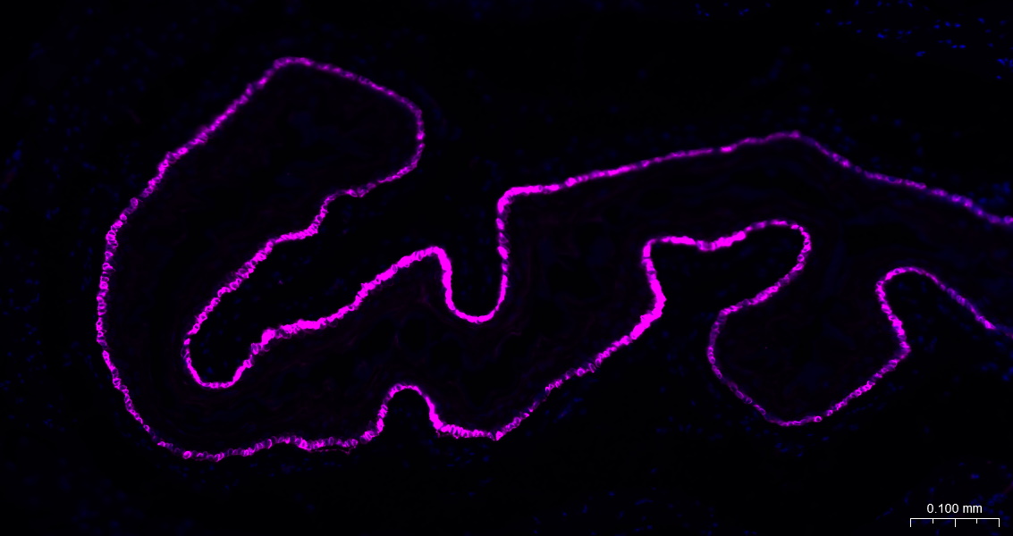 Cytokeratin 14 Recombinant Rab