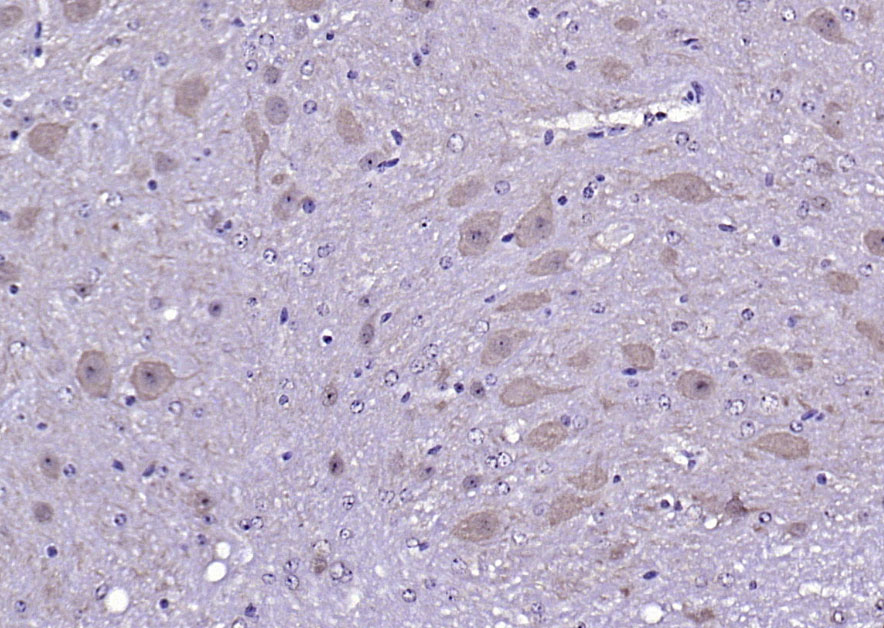 Calmodulin 1/2/3 Rabbit pAb(bs