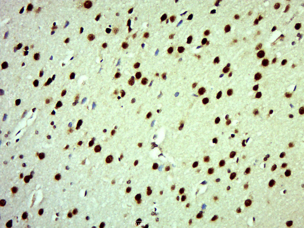 RSK3 Rabbit pAb(bs-3553R)-50ul